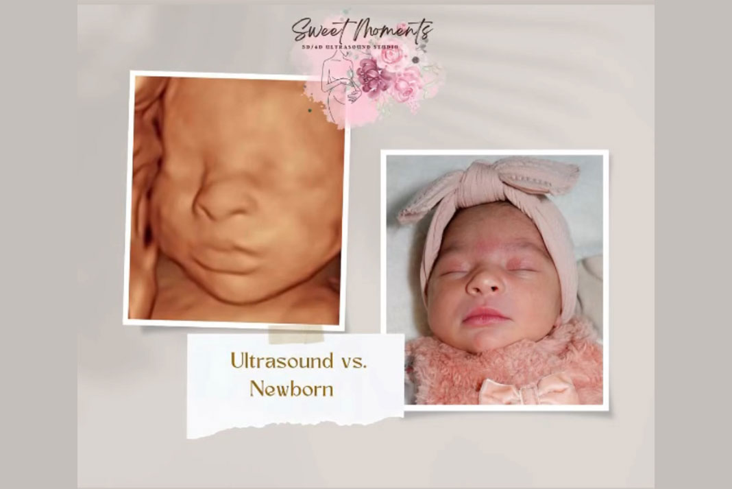 Sweet Moments Ultrasound Studio in Western Mass - Family Life Tips Magazine